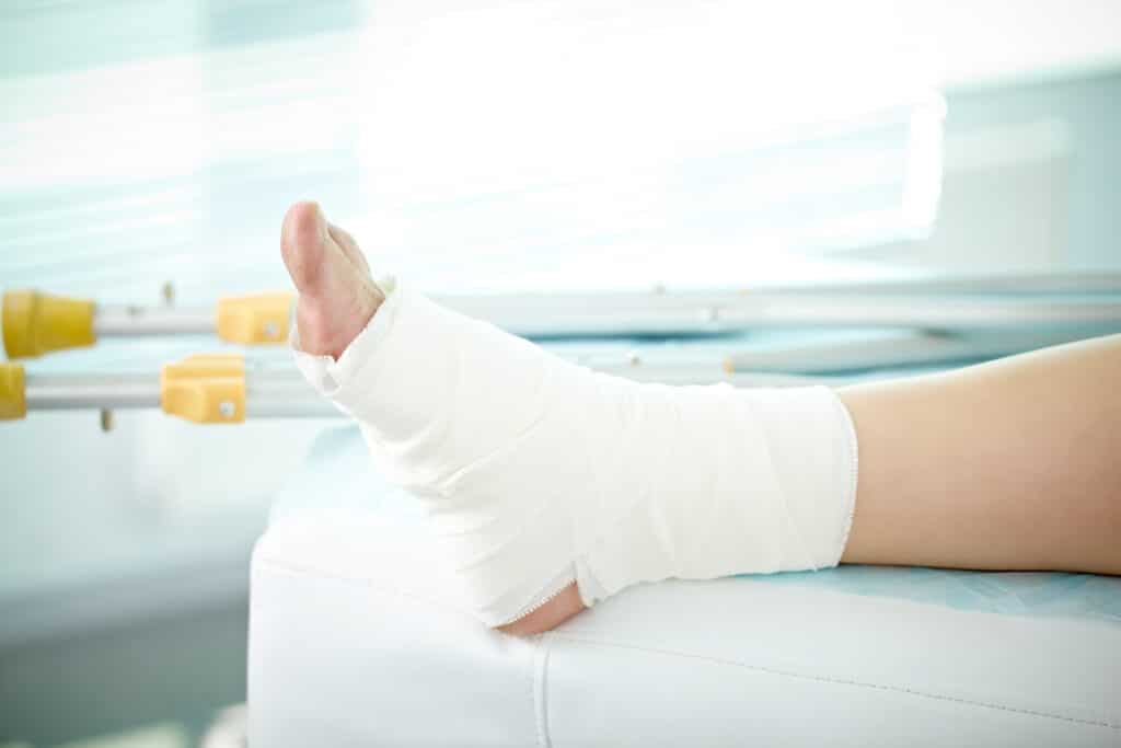 Sprains Treatment Suwanee GA Sprains Treatment Suwanee GA