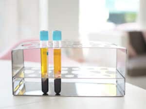 Two tubes of PRP after they have been processed, about to be used for skin and joint treatment