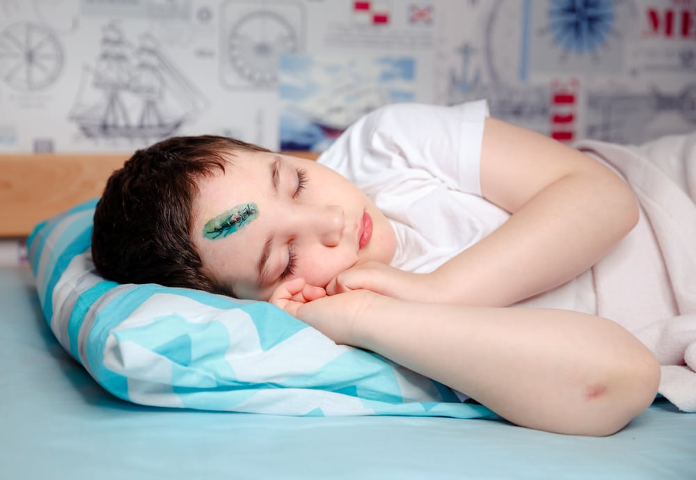 Young boy laying asleep after receiving sutures and other urgent wound care for a large cut on his forehead.